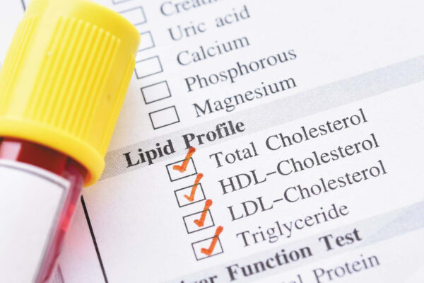 High Density Lipoprotein Cholesterol (HDL Cholesterol)