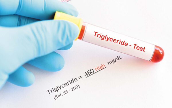Triglycerides-TGL