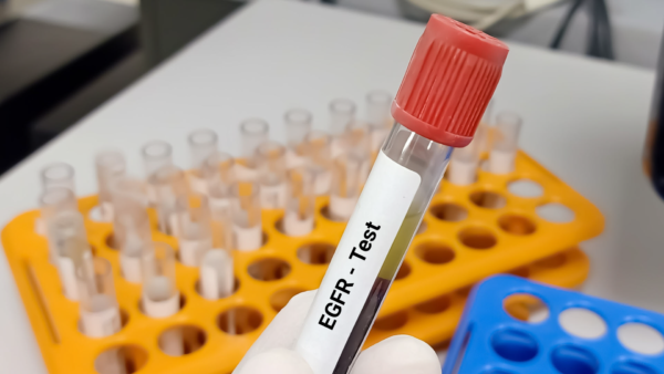 Creatinine with EGFR