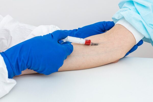 Glucose Challenge Test (GCT)