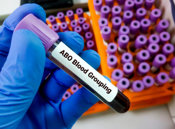 Blood Grouping ABO and Rh Typing (BG)