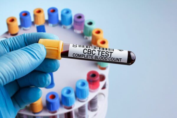 Complete Blood Count-CBC