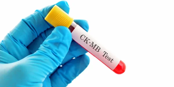 Creatine Phosphokinase MB (CPK MB)