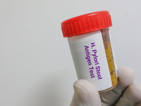 H Pylori Antigen Stool