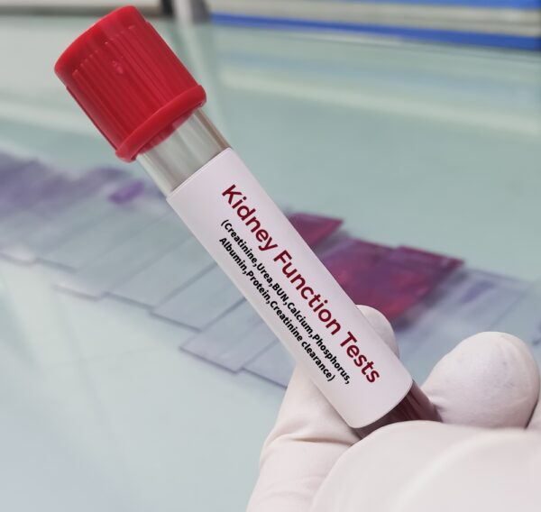 Kidney Function Test Basic