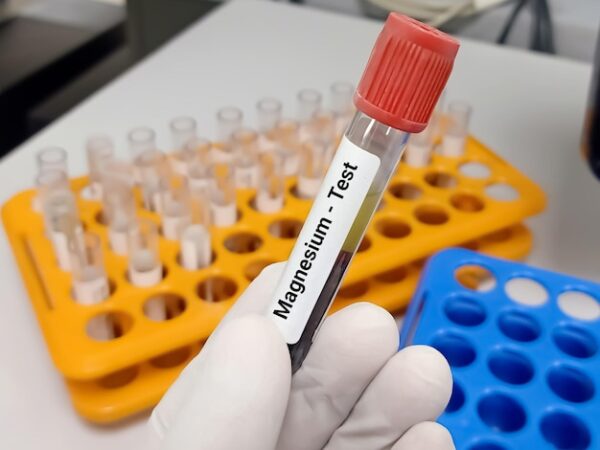 Magnesium (Mg) Urine Random