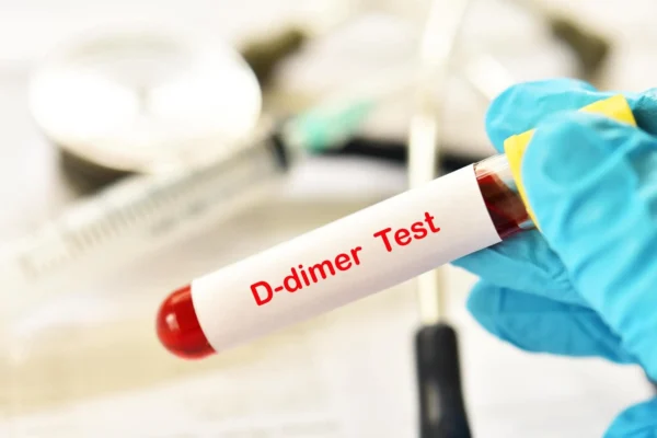 D-Dimer