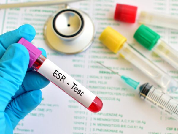Complete Blood Count with ESR (CBC-ESR)