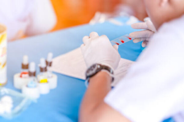 Malarial Antigen By Rapid Card (MP By Card)