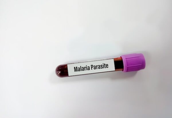 Malaria Parasite detection by Smear (MP By Smear)