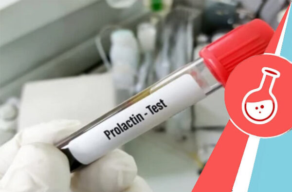 Prolactin-PRL