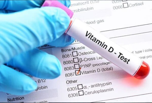 Vitamin D Total